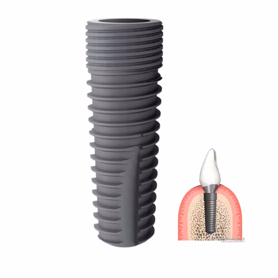 Made in Italy Prótesis Morse Conexiones Dental Isykone Implants
